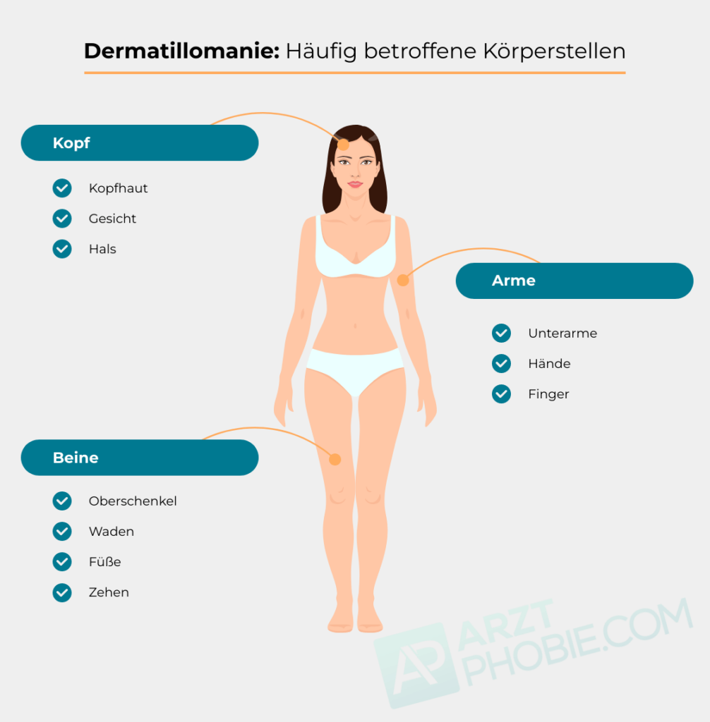 koerperstellen-Dermatillomanie