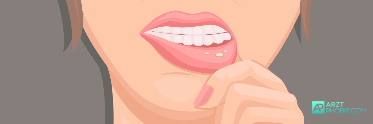 entzuendung-mund-lippen