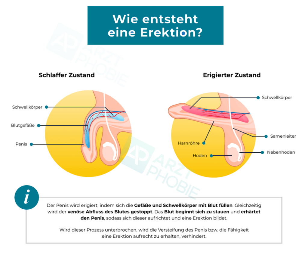 erektion-wie-erektile-dysfunktion