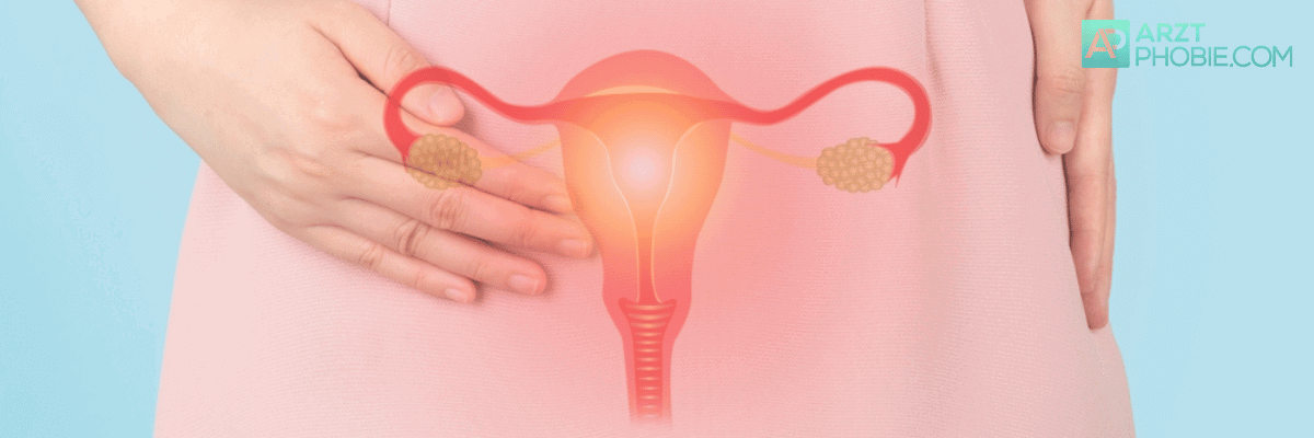 pcos-frauen