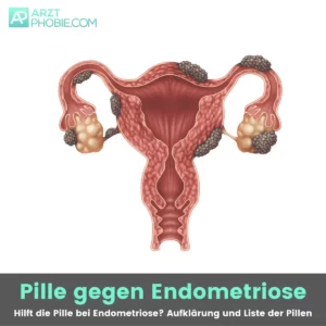 pille-gegen-Endometriose